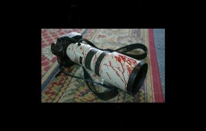 The camera of an injured photographer is covered with blood in 2003. Photo/AFP/Getty Images